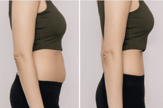 Before and After Image