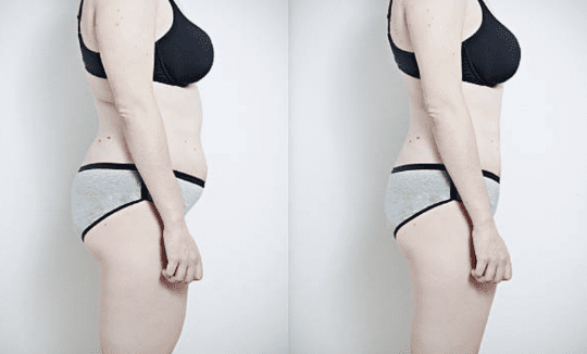 Before and after Image