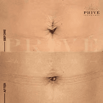 BELLY AREA