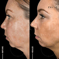 NECK AREA