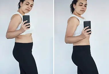Weight loss After-Before Slider 3
